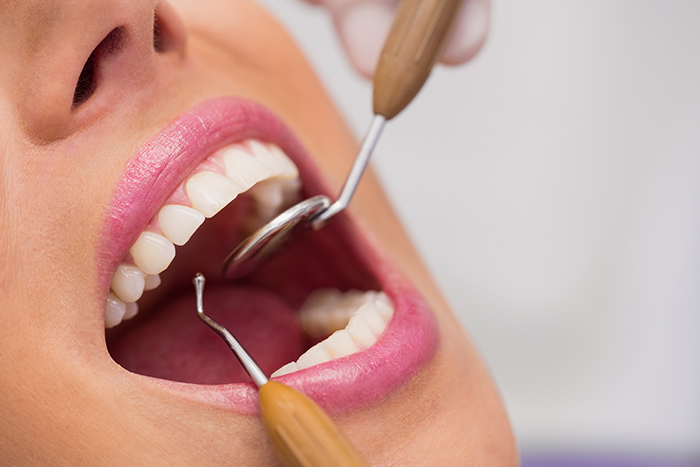 Fases y tipos de dientes