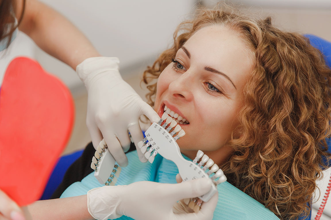 cuidado-mantenimiento-carillas-dentales-clinicas-dentality